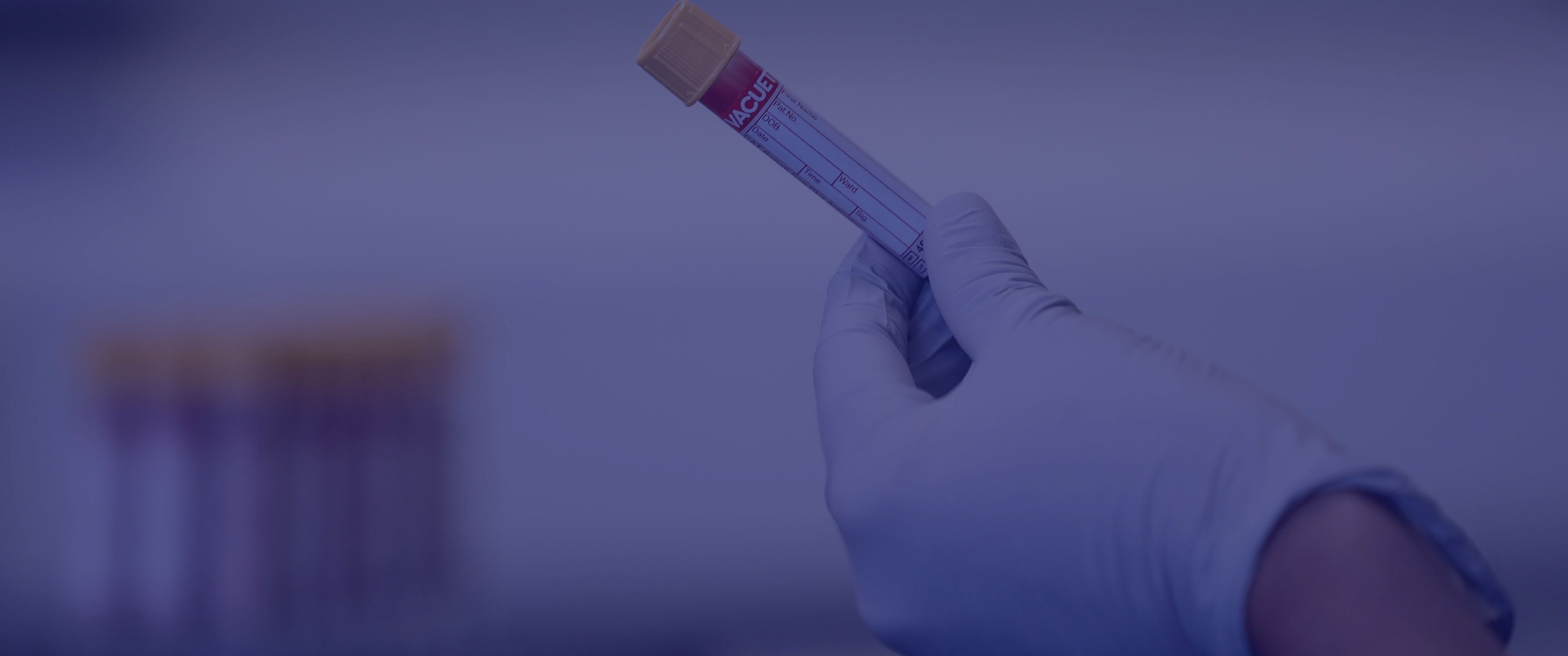 آزمایش آلبومین چیست؟  و تشخیص مشکلات کبدی